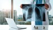 © 锴 张 - Doctor in white coat and blue scrubs holding chest X ray showing ribs, spine and lungs, with laptop on desk in modern clinic, presenting medical diagnosis and healthcare analysis in bright city office