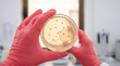© Rendara Studio - Bacterial colony inspection using petri dish in microbiology laboratory