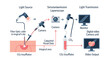 © MDSOHEL - Vector illustration of medical laparoscopy equipment diagram with light source and camera unit