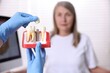 © New Africa - Doctor showing dental implant model to woman in clinic, selective focus