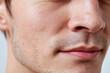 © JoeyMarut - Close up of male cheek and lower face showing skin texture, pores, light stubble and natural lip detail with clinical macro dermatology focus