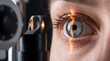 © Kateryna Sharko - Ophthalmology. Macro close-up of a blue eye examined with a slit lamp microscope, showing iris, pupil and cornea during professional diagnostic vision test