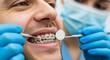 © Pixel Pioneer - Close-up of a man smiling with metal braces on his teeth, undergoing dental examination with dentist