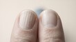 © zokov_111 - Fingers gently display two contrasting nails, one smooth and glossy while the other shows subtle ridges. Soft focus enhances the calming atmosphere, inviting curiosity and reflection.