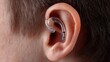 © Amena - Close up view of ear with hearing aid during audiology session showing details of device and ear engagement in a clinical setting