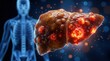 © Masque - Medical concept of liver cancer showing tumor growth on a glowing diseased hepatic organ.