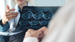 © tippapatt - Doctor examining MRI medical scan film of osteoarthritis in senior patient at hospital or medical clinic. healthcare and medicine concept.