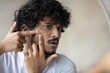 © Prostock-studio - Worried Young Male Of Middle Eastern Descent Inspecting Skin Condition On His Face While Looking In Mirror, Focusing On A Specific Spot, Sitting At Home, Personal Care Concept.
