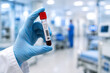 © Diego - Muestra con sangre, ensayo clínico y tubo de ensayo con sangre en laboratorio analítica blood test enfermedad en analysis hospital, cultivo sanguíneo de enfermo e investigación
