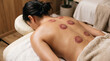 © Bushra - Patient resting after cupping therapy session showing circular marks on back
