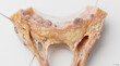 © Rahul - Detailed microscopic view of biological tissue sample showing diseased cartilage with visible nodules and plaque