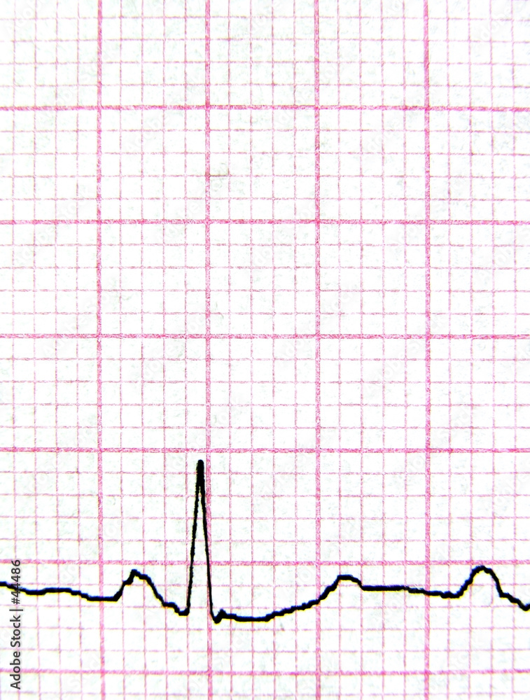 real ekg (macro) real ekg (macro)