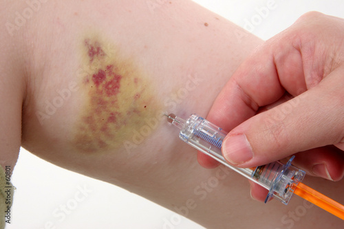 daily injections