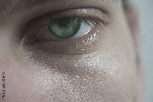 depressed eye