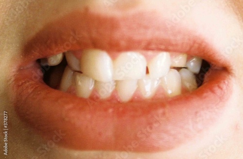 teeth 2