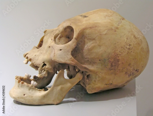 prehistoric skull
