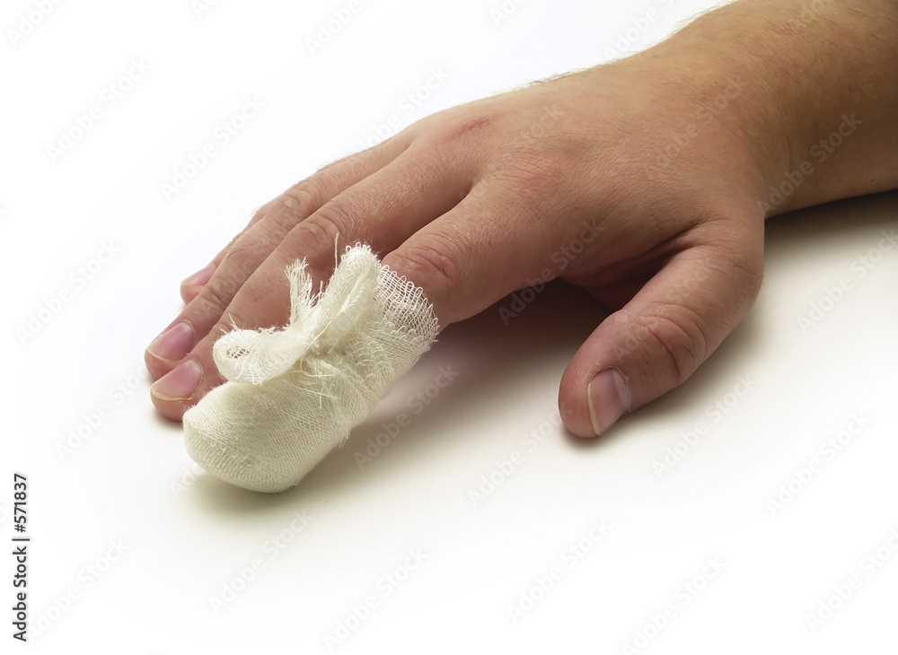 Photography laceration