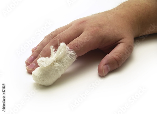laceration