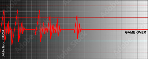 cardiogram ending with 'game over'