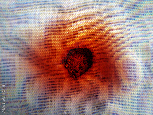 burnt cloth