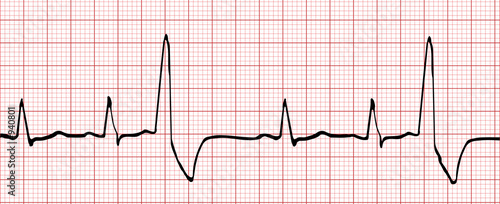 électrocardiogramme