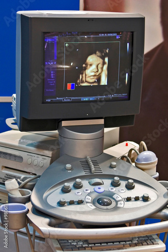 ultrasound medical 3d scanner