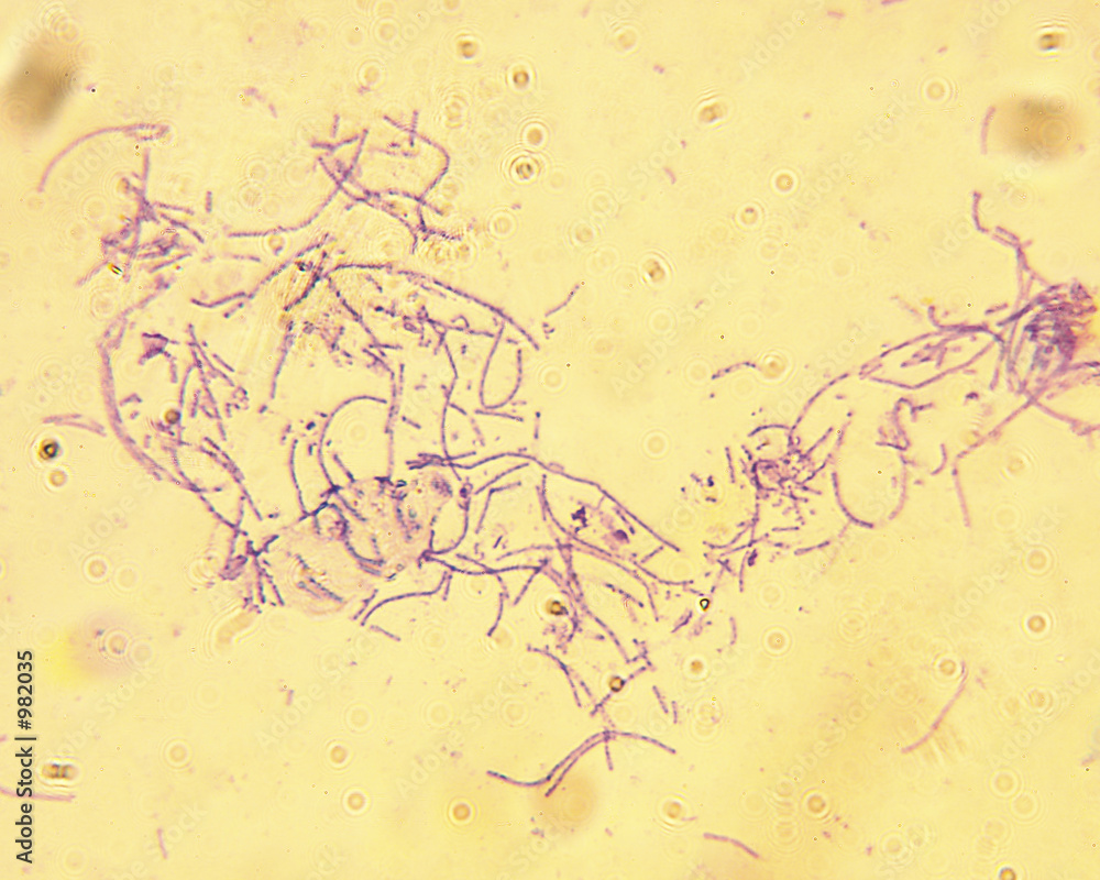 Obraz na plátne microscope-anthrax-bacillus anthracis