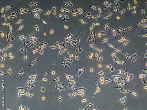 cervical cancer cells