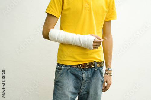 arm in gips photo