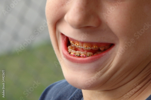 brace face...