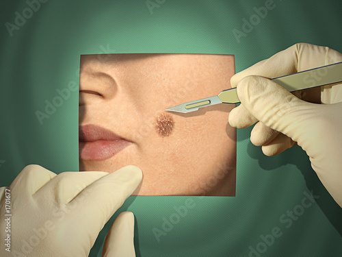 cosmetic surgery