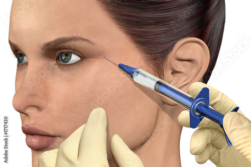 cosmetic injection