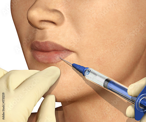 lip enhancement