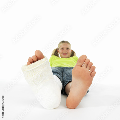 girl with a broken leg