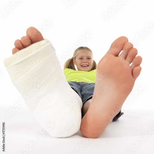 girl with a broken leg