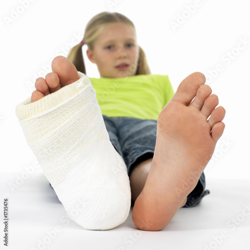 girl with a broken leg