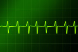 cardiogram ritm