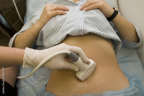scanning of a stomach of the woman.