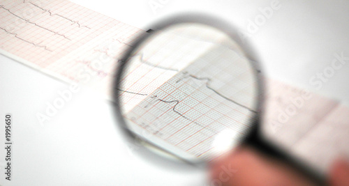 Vászonkép cardiogram  watched  threw the magnifying glass