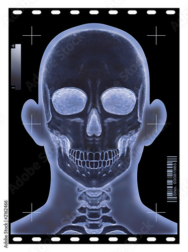 head x-ray