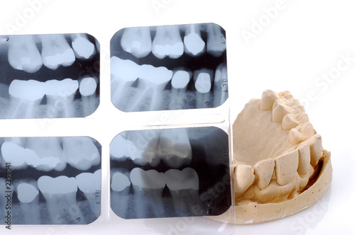 dental  x-ray
