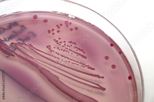 bacterial colonies photo