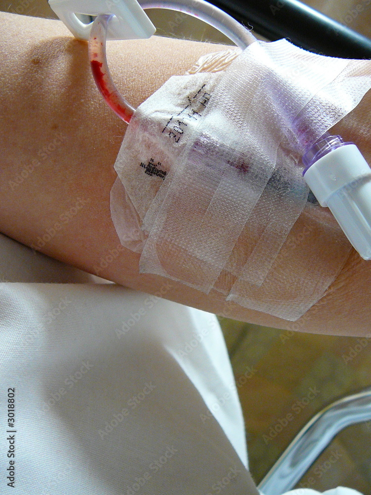 patient's arm prepped for iv drip Stock Photo Adobe Stock