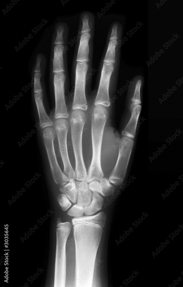 left hand left hand