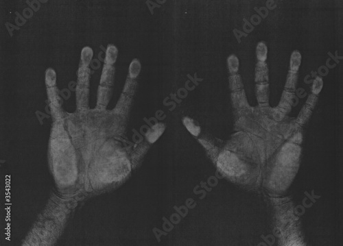 Photocopied hands, left and right