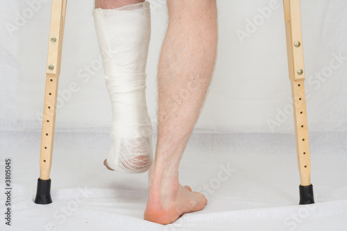 The person with plaster on a foot stands on a floor photo