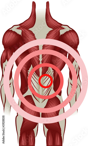 Back pain Muscles of the back radiating pain