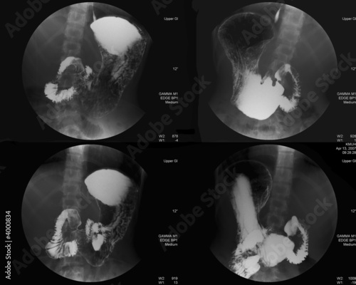 Stomach Radiology