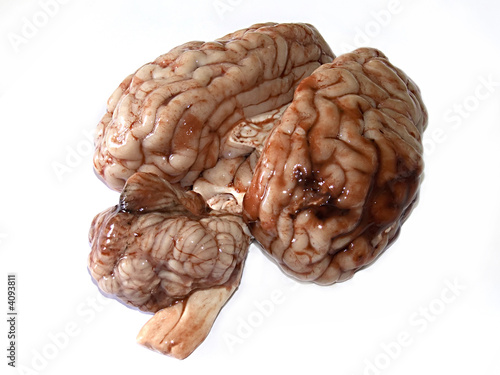 Brain