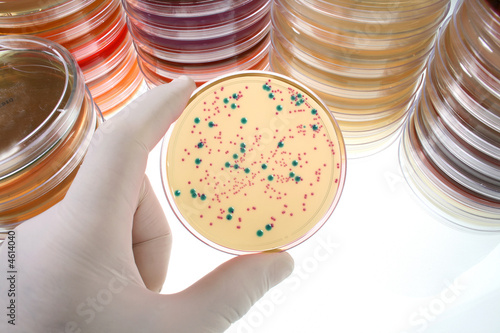 Obraz na plátně Petri dishes for medical research